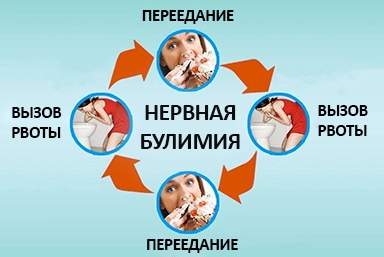 Лечение булимии в Иваново
